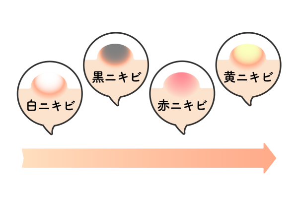 nikibi2.png